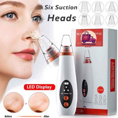 Rechargeable Blackhead Remover